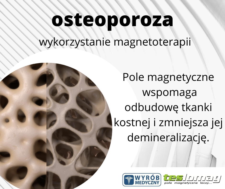 Osteoporoza - leczenie polem magnetycznym