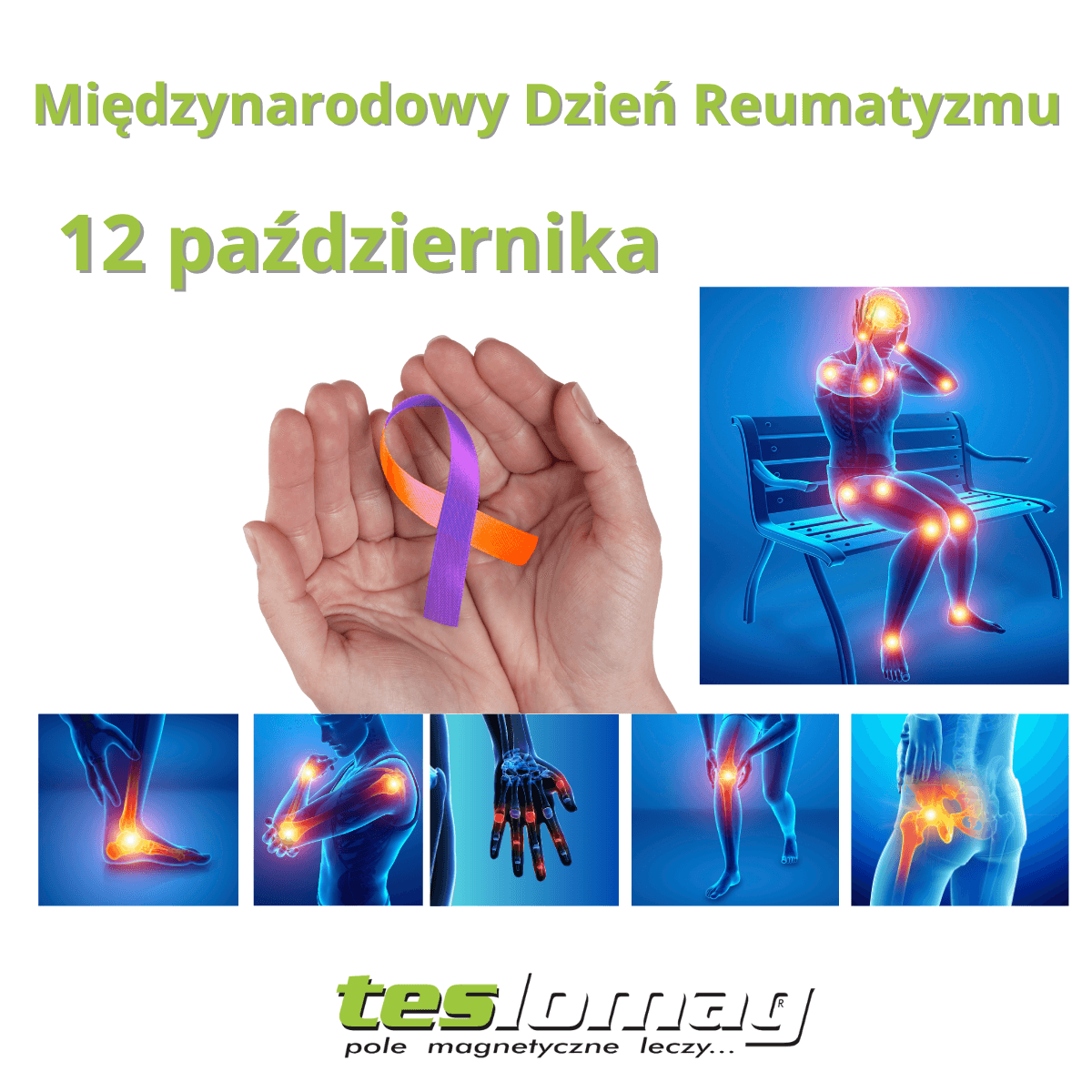 Międzynarodowy Dzień Reumatyzmu – rola magnetoterapii w leczeniu przewlekłego bólu